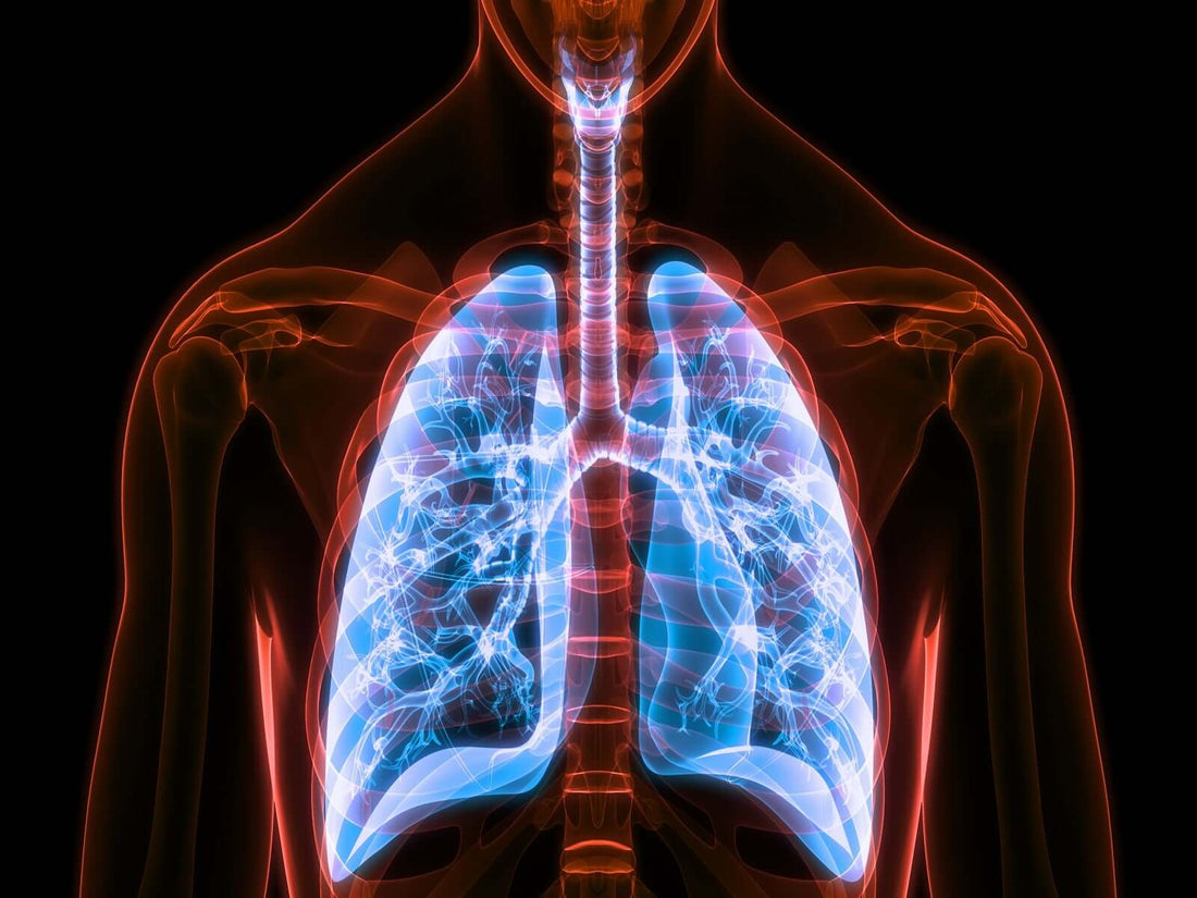 Lung x-ray showing the characteristic changes caused by COVID-19, including infiltrates and consolidation in both lungs.